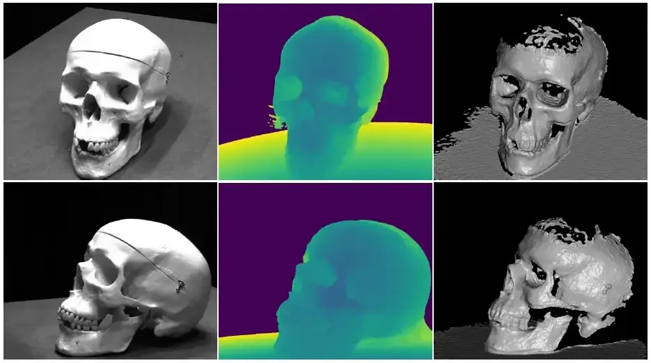 Reconstructed Skull model